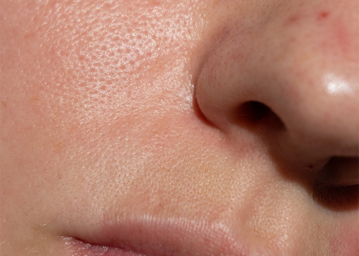 After A Brighter, Smoother Complexion